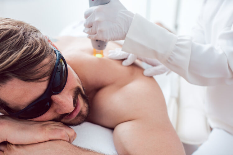 Seattle Mens Laser Hair Removal